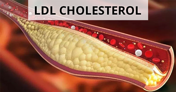 Quickest Way to Lower LDL Cholesterol - Dr. Sam Robbins