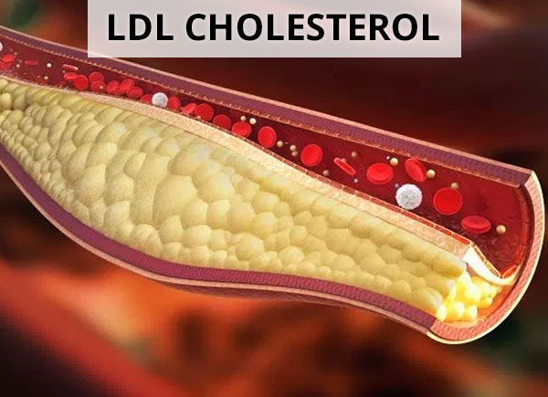 What Is The Desirable Ldl Bad Cholesterol Level Dr Sam Robbins 2659