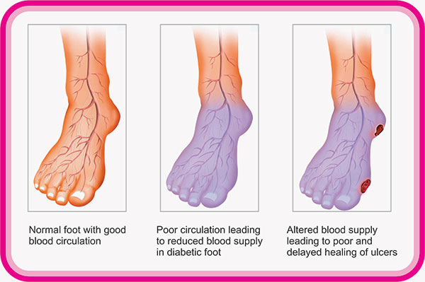 seven-strategies-to-increase-blood-flow-in-your-feet-in-20-days-youtube