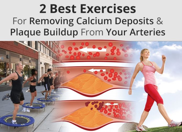 Exercises For Removing Calcium Deposits & Plaque Buildup From Arteries