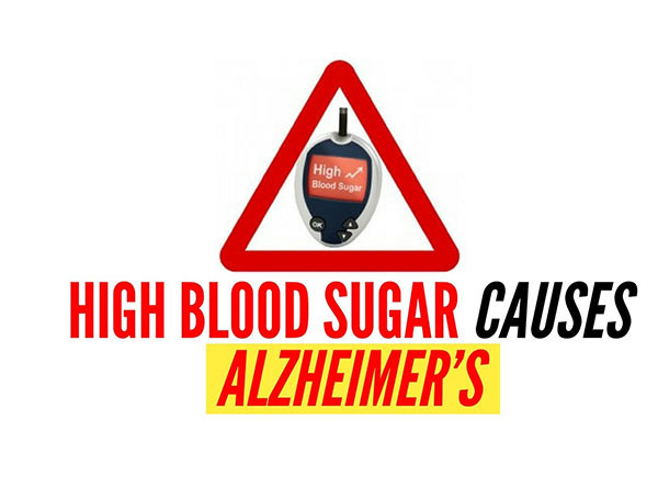 High Blood Sugar Causes Alzheimer’s