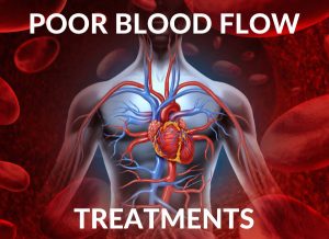Poor Blood Flow & Circulation Treatments