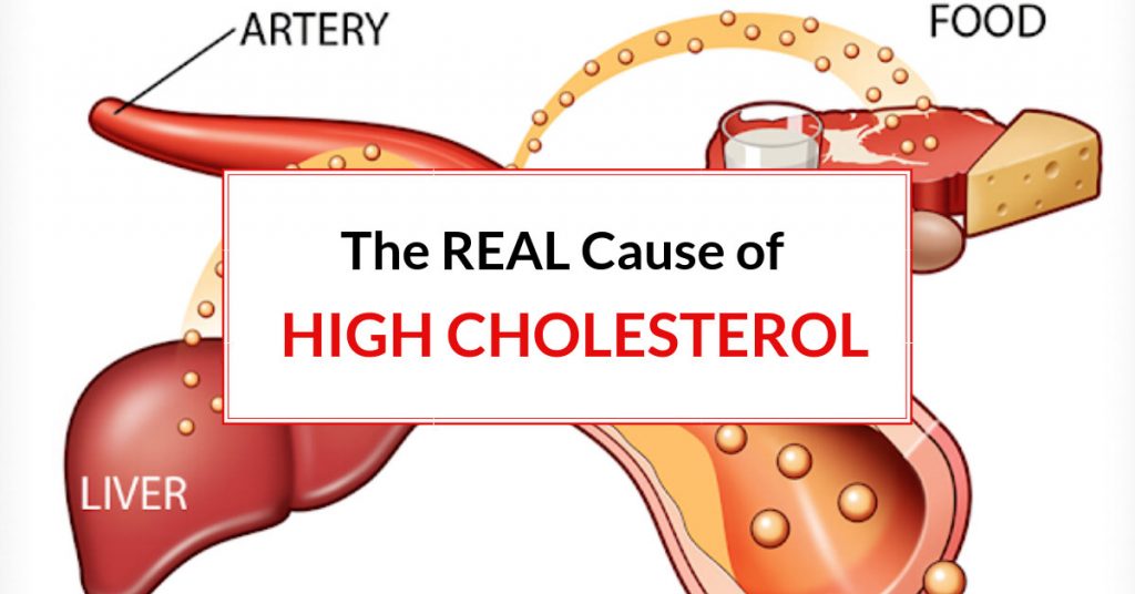 Dr Reveals The Real Cause Of High Cholesterol Dr Sam Robbins 6648