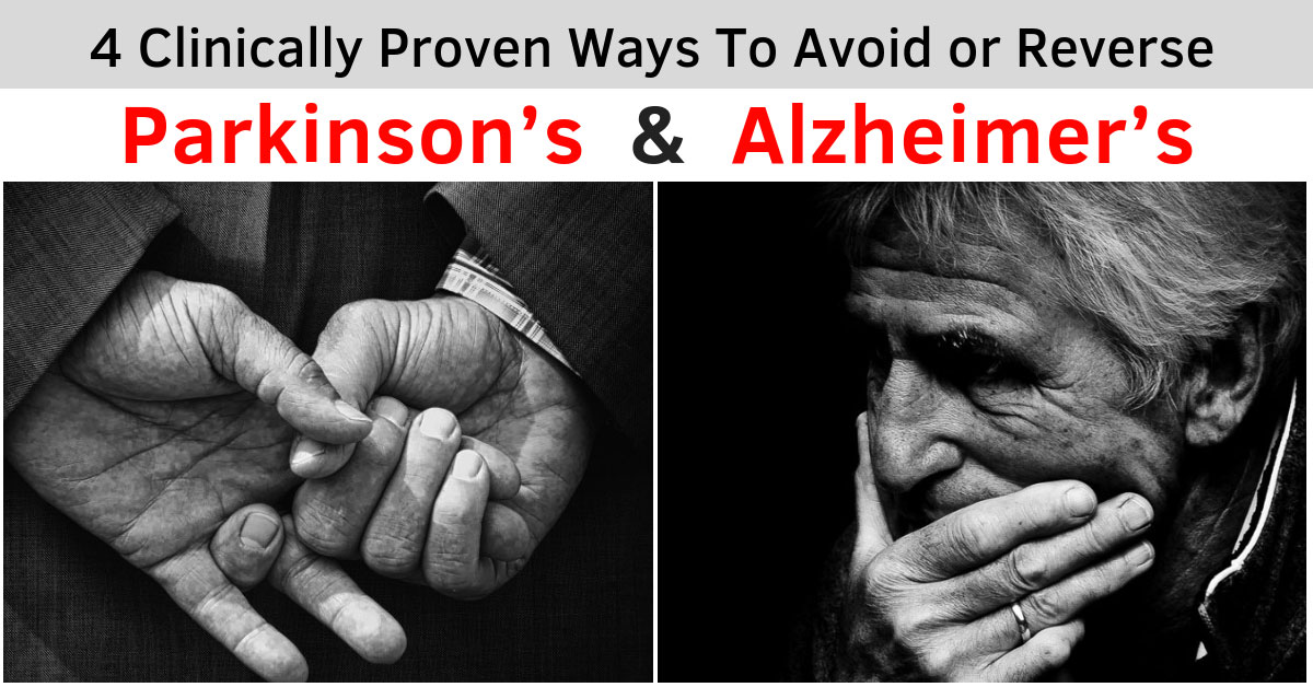 can alzheimers patients get parkinsons