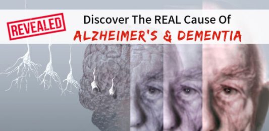 Revealed: Discover The REAL Cause Of Alzheimer’s & Dementia