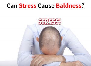 Can Stress Cause Baldness