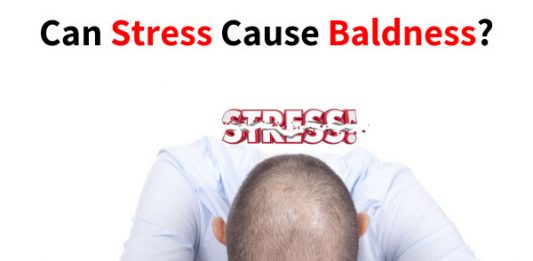 Can Stress Cause Baldness