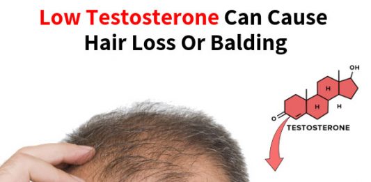 Low Testosterone Can Cause Hair Loss Or Balding