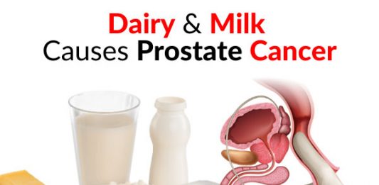 WARNING: Dairy & Milk Causes Prostate Cancer
