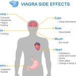 viagra side effects