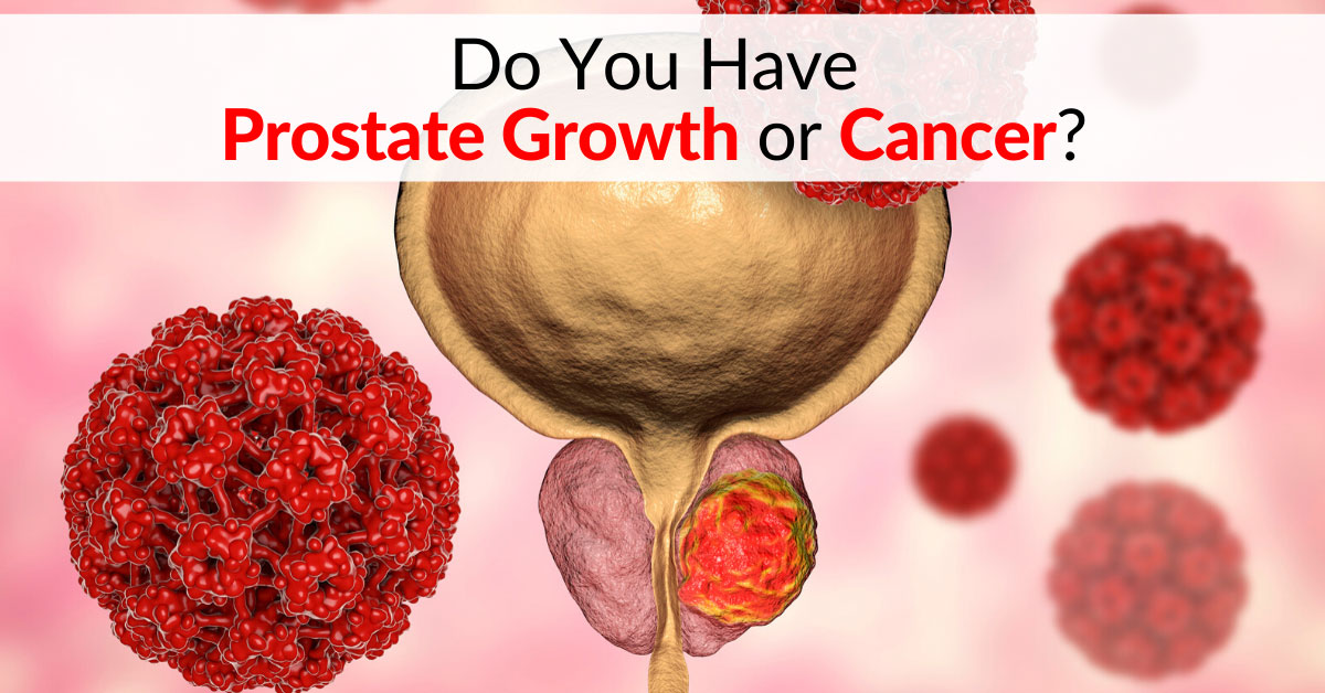 Do You Have Prostate Growth or Cancer? Read this Article