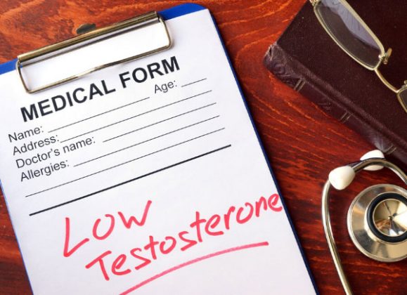 Low Testosterone Dr Sam Robbins 8553