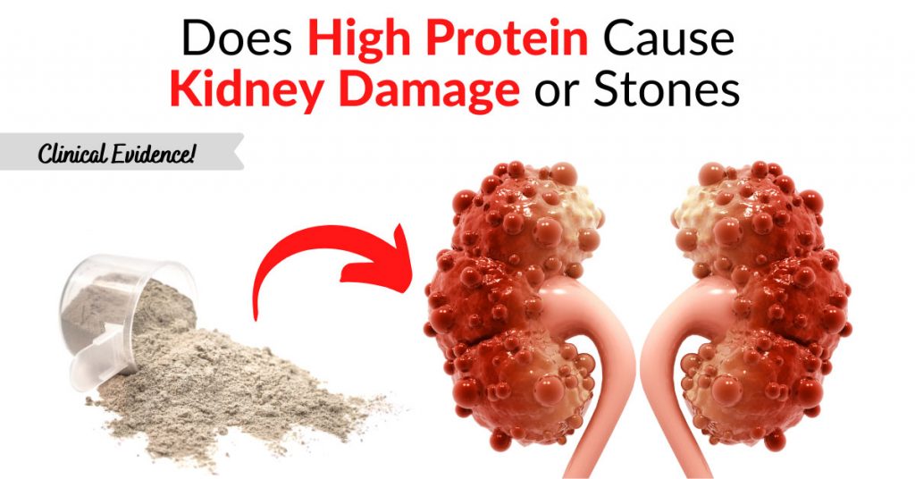 does-high-protein-cause-kidney-damage-or-stones-clinical-evidence