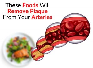 These Foods Will Remove Plaque From Your Arteries
