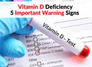 Vitamin D Deficiency - 5 Important Warning Signs