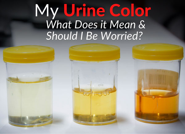 My Urine Color - What Does it Mean & Should I Be Worried?