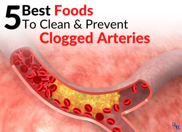 5 Best Foods To Clean & Prevent Clogged Arteries - Clinically Proven