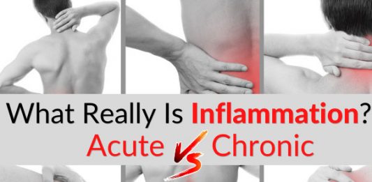 What Really Is Inflammation. Acute vs Chronic