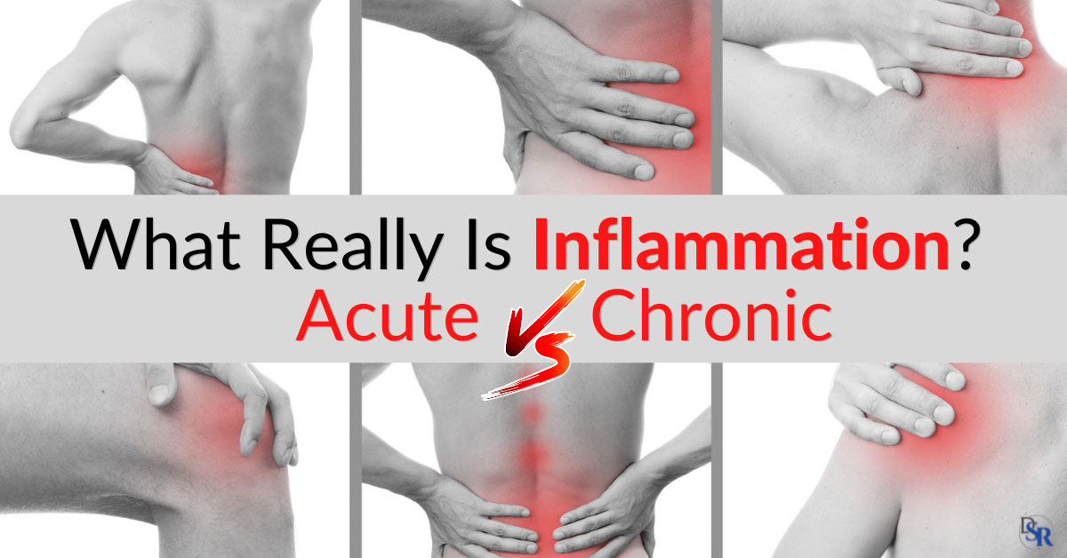 What Really Is Inflammation Acute Vs Chronic Dr Sam Robbins