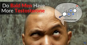 Do Bald Men Have More Testosterone