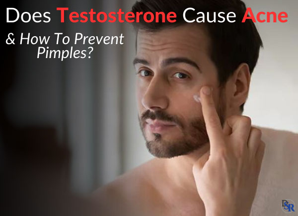 Does Testosterone Cause Acne & How To Prevent Pimples?